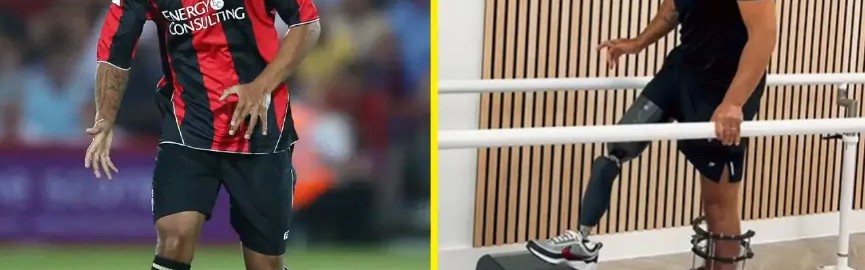 欧博官网-talkSPORT：一名女子酒驾导致前伯恩茅斯球员失去一条腿